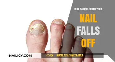 Nail Loss Pain: What to Expect When Your Nail Falls Off