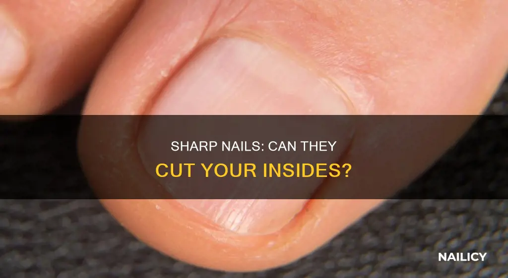is it possible to cut your insides with a nail