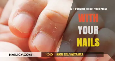 How Nails Can Cut Your Palm