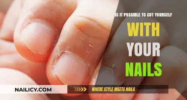 How Your Nails Can Cut You