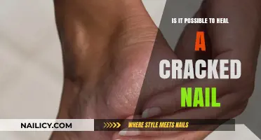 Healing Cracked Nails: Effective Tips and Remedies for Repair