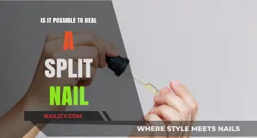 Healing Split Nails: Effective Remedies and Prevention Tips Revealed