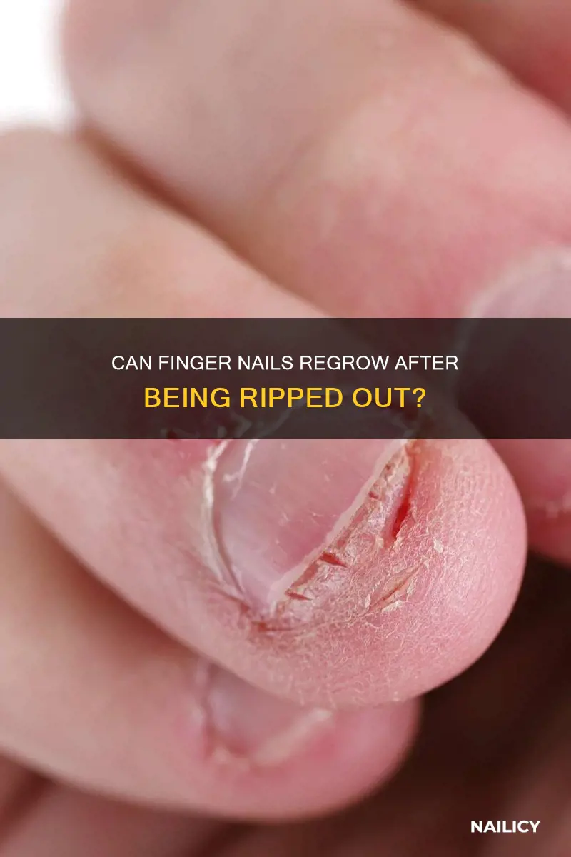 is it possible to permanently lose a finger nail