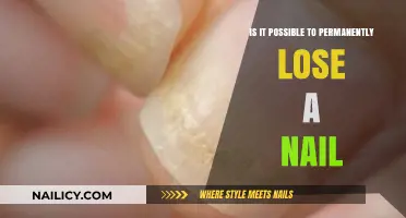 Can Nails Be Lost Forever? Understanding Permanent Nail Loss Causes