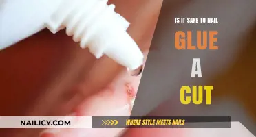 Is Super-Gluing Your Cut a Safe Option?