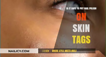 Is Nail Polish Safe for Skin Tags? Risks and Alternatives