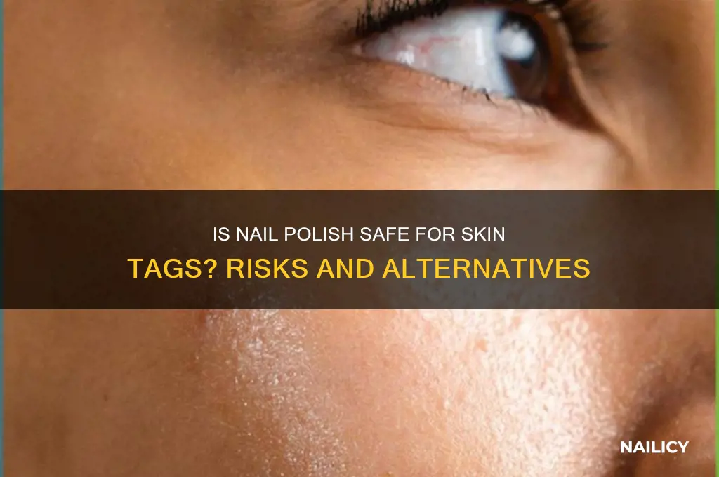 is it safe to put nail polish on skin tags