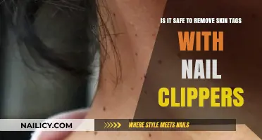 Safe Skin Tag Removal: Clippers vs Nails