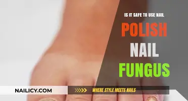 Nail Polish and Fungus: Safe Solution or Risky Remedy?