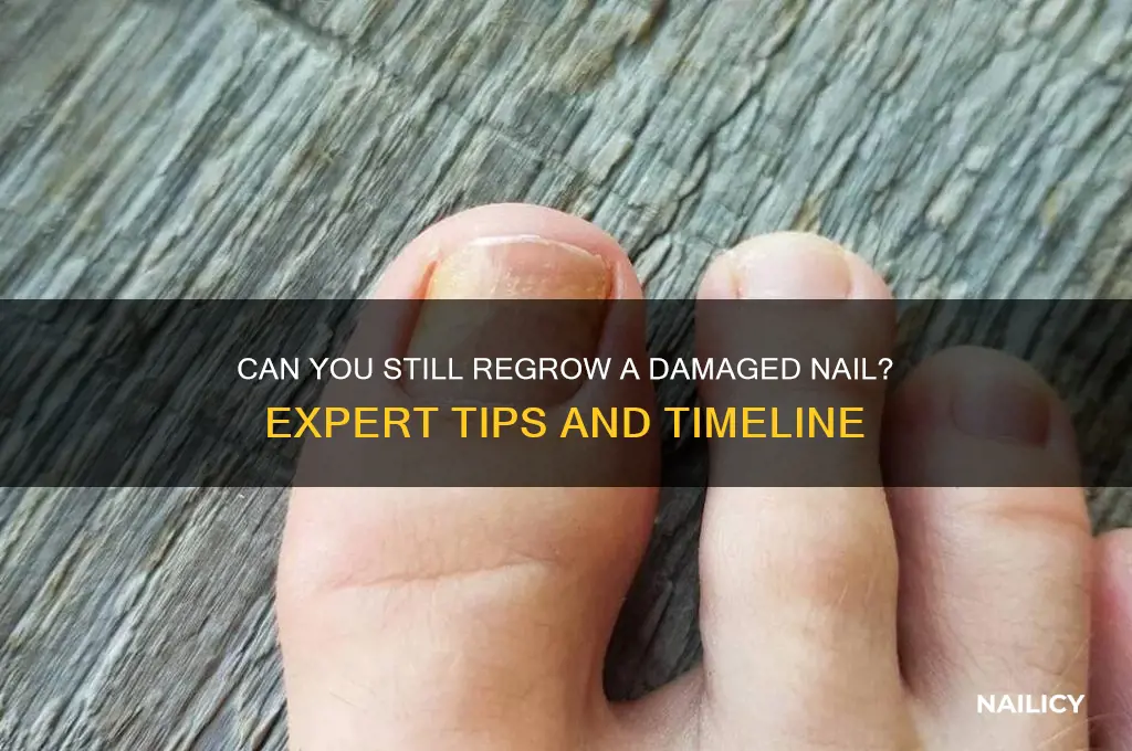 is it too late to regrow a nail