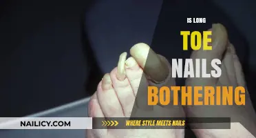 Long Toenails: A Painful and Annoying Problem