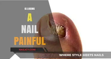 The Surprising Truth About Losing a Nail: Pain and Prevention
