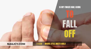 Fingernail Falling Off: What to Expect and Why