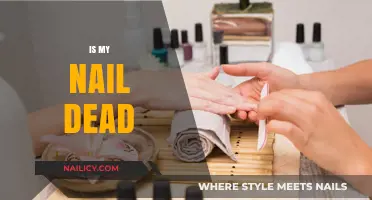 Reviving Your Nail Health: Signs of Damage and How to Fix It