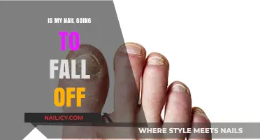 Is My Nail Going to Fall Off? Causes, Symptoms, and Treatment
