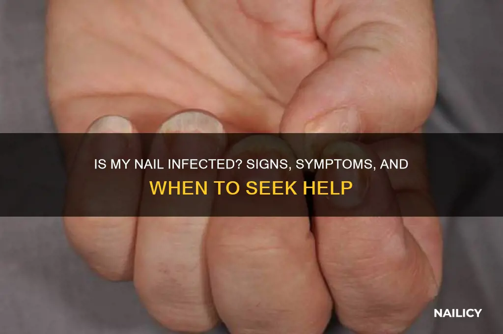 is my nail infected