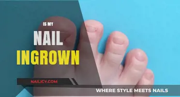 Is Your Nail Ingrown? Signs, Symptoms, and Simple Solutions