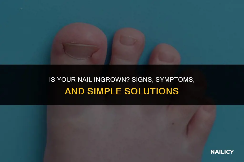 is my nail ingrown