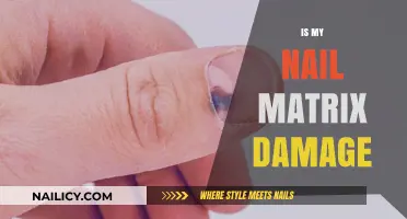 Unveiling the Truth: Is Your Nail Matrix Really Damaged?