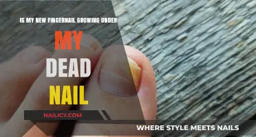 How Nails Regenerate: Understanding Nail Growth