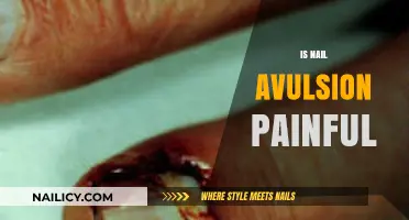 Understanding Nail Avulsion: Causes, Symptoms, and Effective Treatments