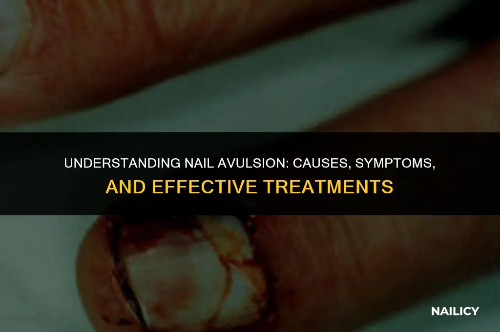 is nail avulsion painful