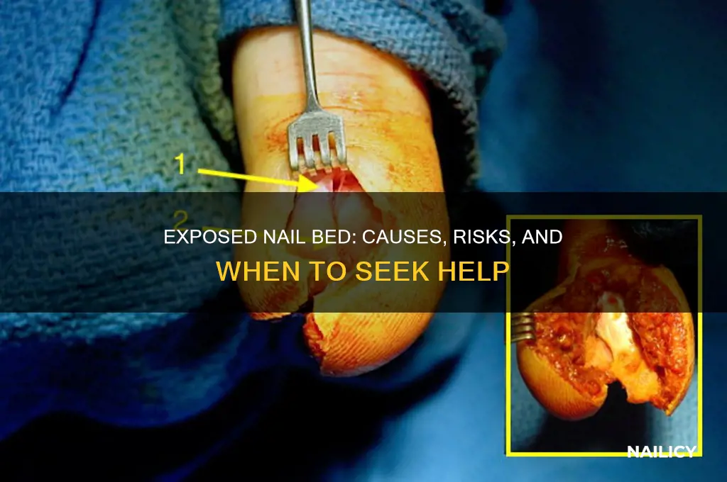 is nail bed being exposed an issue