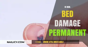 Can Nail Bed Damage Be Reversed? Expert Insights Revealed