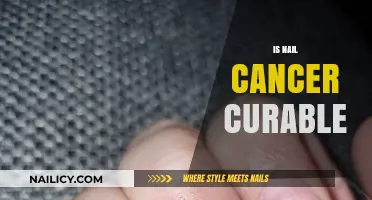 Hope and Healing: Understanding the Journey of Nail Cancer Recovery