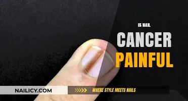 Understanding Nail Cancer: Symptoms, Diagnosis, and Treatment Options