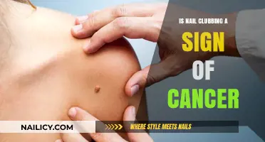 Nail Clubbing and Cancer: Understanding the Potential Link and Risks