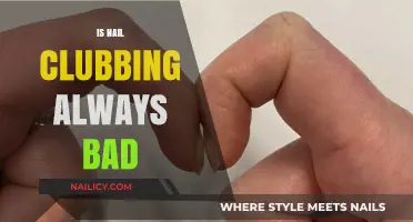 Exploring the Myths and Truths: Is Nail Clubbing Always Harmful?