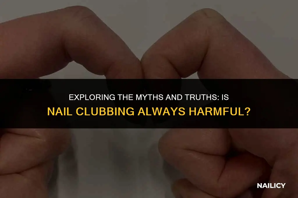 is nail clubbing always bad