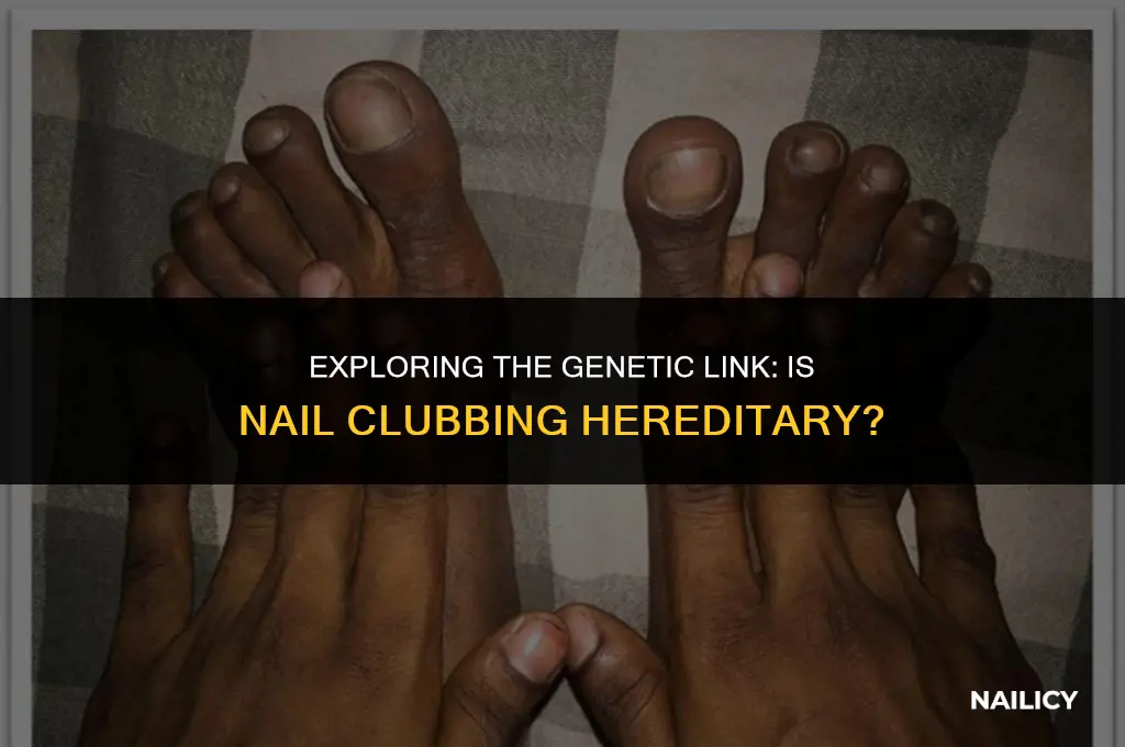 is nail clubbing hereditary