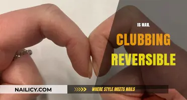 Reversing Nail Clubbing: A Comprehensive Guide to Healthier Nails