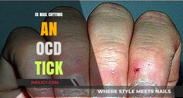 OCD and Nail Cutting: What's the Connection?