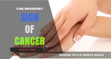 Nail Discoloration and Cancer: What Your Nails May Reveal