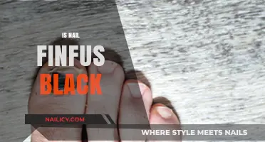 Exploring the Myth: Is Nail Fungus Always Black?