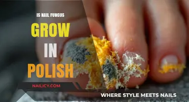 Can Nail Fungus Thrive Under Polish? Uncovering the Truth