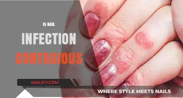 Understanding Nail Infections: Causes, Symptoms, and Contagion Risks