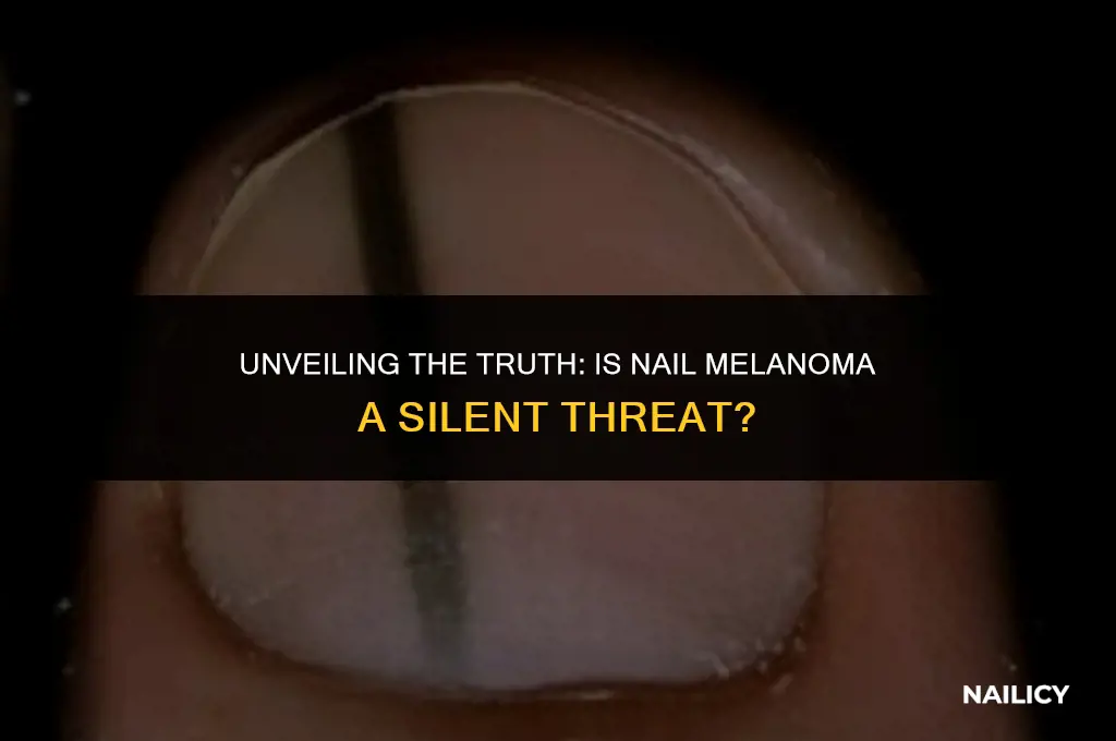 is nail melanoma dangerous