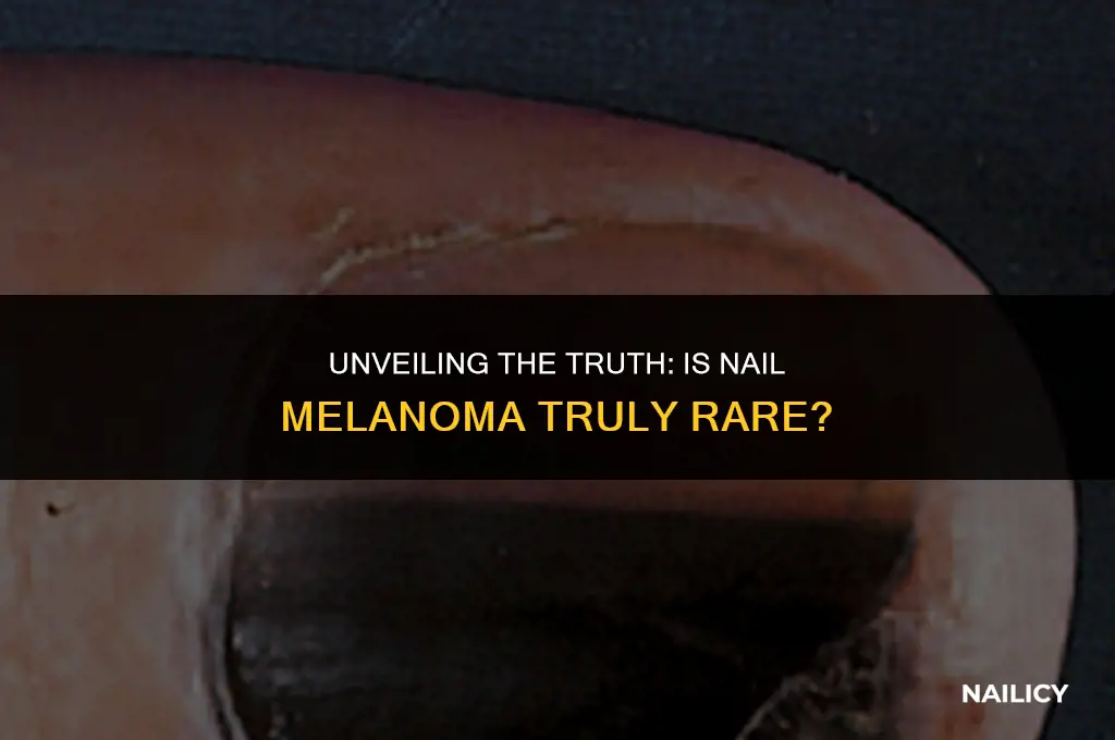 is nail melanoma rare