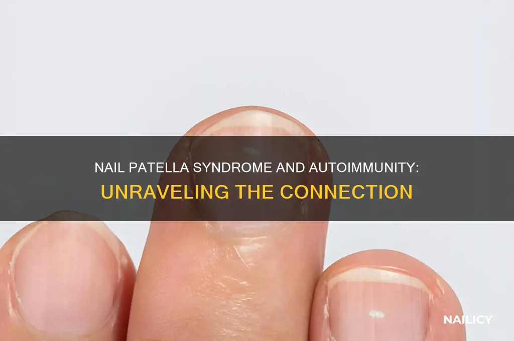 is nail patella syndrome an autoimmune disorder
