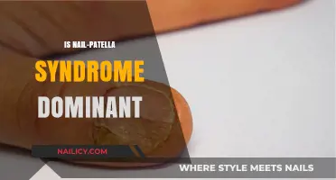 Unraveling Genetics: Is Nail-Patella Syndrome Dominant?