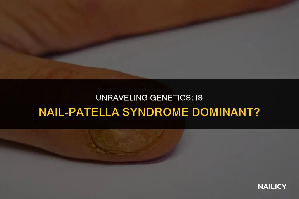 is nail-patella syndrome dominant