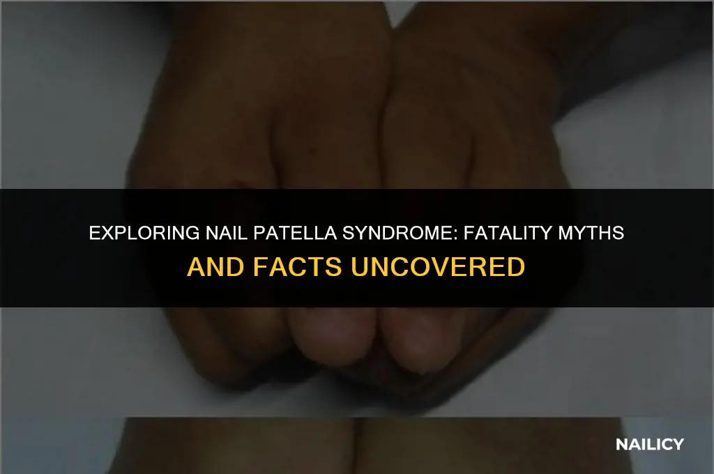 is nail patella syndrome fatal