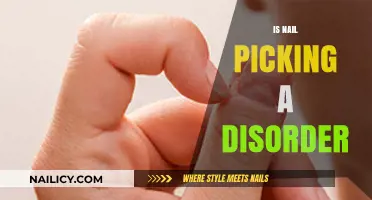 Understanding Trichotillomania: Is Nail Picking a Disorder?
