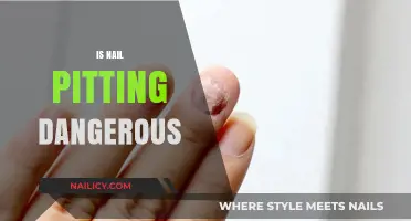 Unveiling the Truth: Is Nail Pitting a Harmless Habit or a Health Hazard?