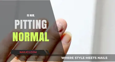 Understanding Nail Pitting: Causes, Symptoms, and Treatments Explained