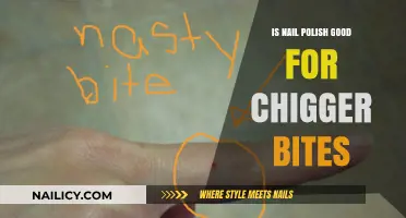 Nail Polish for Chigger Bites: Effective Remedy or Myth?